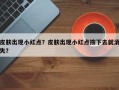 皮肤出现小红点？皮肤出现小红点按下去就消失？