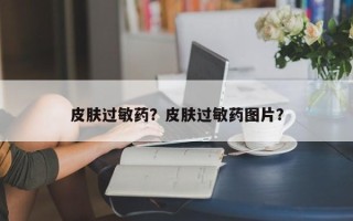 皮肤过敏药？皮肤过敏药图片？