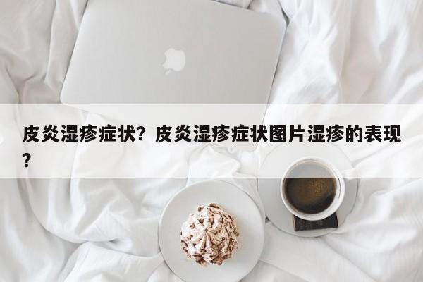 皮炎湿疹症状？皮炎湿疹症状图片湿疹的表现？-第1张图片-890百科网